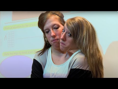 Das siamesische Zwillingspaar Abby und Britt lyteCache.php?origThumbUrl=https%3A%2F%2Fi.ytimg.com%2Fvi%2FcbIPVo4XnLI%2F0 